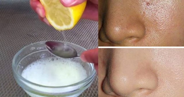 Only 2 Ingredients And The Pores On Your Face Will Disappear Forever! Read the 6 Steps