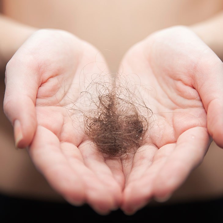 Tips To Help You Cope With Hair Loss During Pregnancy