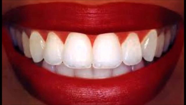 Do These Tips Today and your Teeth will turn Sparkling White
